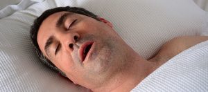 Read more about the article Effect of RMST on sleep architecture in obstructive sleep apnea